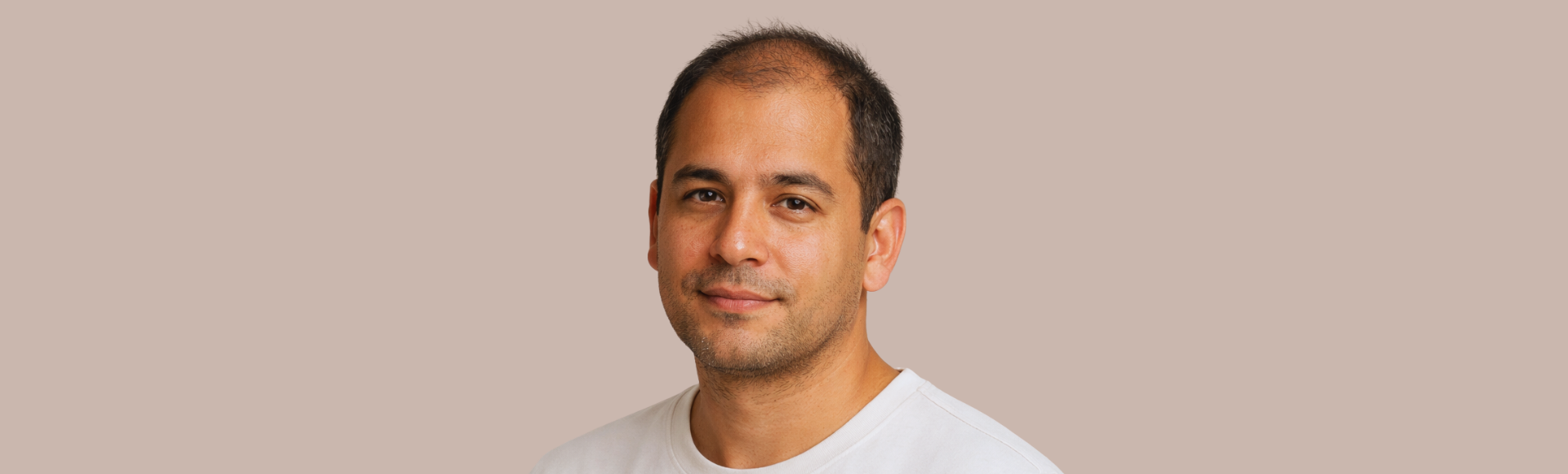 Tratamiento de caída de pelo - Dermatología