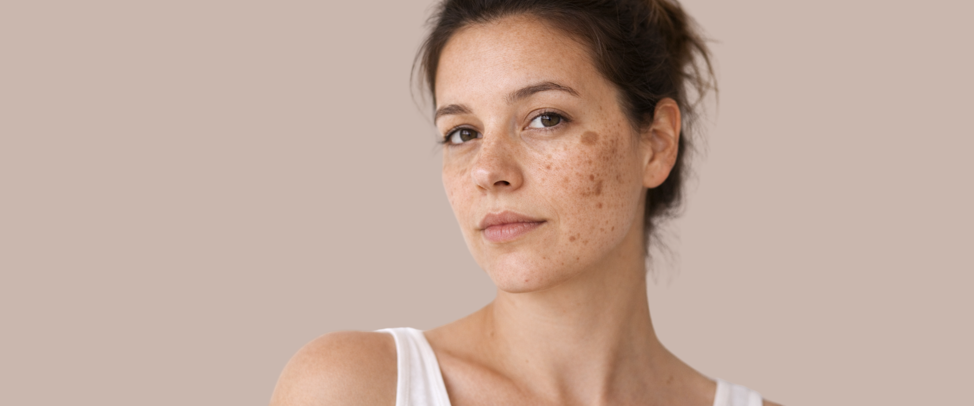 Tratamiento de manchas en la piel - Dermatología